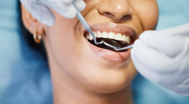Best Emergency Dentist for Knocked-Out Tooth in Rangely, CO